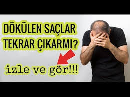 Dokulen Saclar Yeniden Nasil Cikar Youtube Sac Youtube Saglik