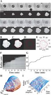 For example, a dust mite is typically 200 µm in size. Nanometer Analysis Of Cell Spreading On Matrix Coated Surfaces Reveals Two Distinct Cell States And Steps Biophysical Journal