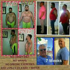 Pin On Truvision Business