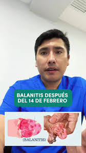 Videos de Dr.Jhon Vilca-Cirujano Urólogo (@dr.vilca.urologo) con “sonido  original