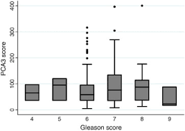 pca3 score of 20 could improve prostate cancer detection