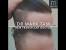 Hair Transplant Procedure