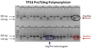 List of 2 cancer definitions. Cancers Free Full Text Protein Oxidative Damage In Uv Related Skin Cancer And Dysplastic Lesions Contributes To Neoplastic Promotion And Progression Html