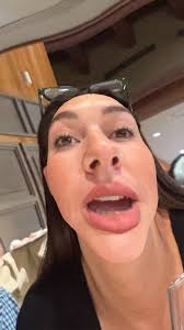 Max Atkinsシ (@maximillian4422)