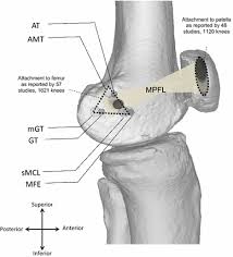(2017) knee surgery, sports traumatology, arthroscopy : Figure 2 Origin And Insertion Of The Medial Patellofemoral Ligament A Systematic Review Of Anatomy Springerlink