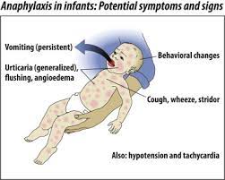 Anaphylaxis Unique Aspects Of Clinical Diagnosis And Management In Infants Birth To Age 2 Years Journal Of Allergy And Clinical Immunology