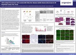 Cells Isolated From Donors With Nonalcoholic Fatty Liver