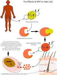 However, overproduction of testosterone in women can lead to a deep voice and thick hair on the face, chest, abdomen, arms, and legs. Hair Loss Due To Dht