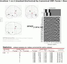 Type spm space followed by ic no space angka giliran and send to 15888. 4 Results Assessment Spm Results Ui M This Section Deals With The Interactive Exploration And Characterisation Of The Results Of A Statistical Analysis For This Purpose Three Data Sets Will Be Discussed Which Can Be Found At Http Www Fil Ion Ucl Ac Uk Spm