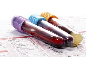 E' la neutropenia grave quella più pericolosa. Globuli Bianchi Bassi O Alti Cause E Rimedi