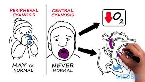 Image result for Hypoxis cuanzensis