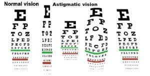 Depending on your screen size, position yourself as follows Astigmatism First To Disappear With Natural Vision Improvement Happy Eyesight