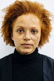 Dark hair and freckles even look intriguing and charming combined. Can Black People Have Freckles Quora