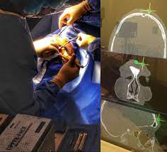 I am still under my parent's insurance (blue cross blue shield) and just about everything was covered under insurance. Facial Feminization Surgery Ffs Insurance Coverage Dr Keojampa