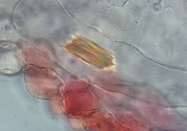 Image result for Raphidiocystis