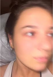 Open Your Eyes Based