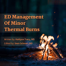 Image result for Burn Management
