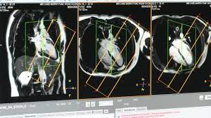 Maybe you would like to learn more about one of these? Study Covid 19 May Cause Long Term Heart Damage 6abc Philadelphia