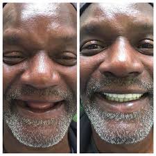 Come check out our cosmetic dentistry before and after photos from our dental patients. Vestavia Al Dentist