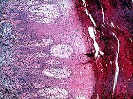 We did not find results for: Reiter S Syndrome American Urological Association