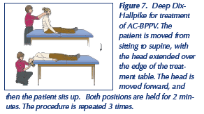 Image result for Canalith Repositioning Procedure