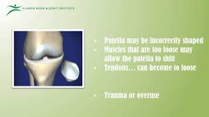 Image result for Patella Tracking Assessment