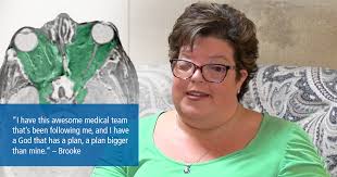 Skull base meningioma, Brooke's story