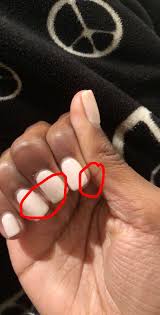 Instead of using acetone, you can use alcohol or vodka to remove sns nails. Got Sns Nails For The First Time 3 Days Ago And I Have All These Cracks All Over My Nails Went Back The Day After Getting Them Done To Have 2 Of