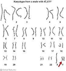 Xyy Syndrome Wikipedia