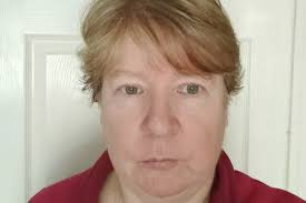 NI men open up about suffering life-changing brain injuries