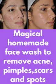 Pin On 100 Coconut Oil