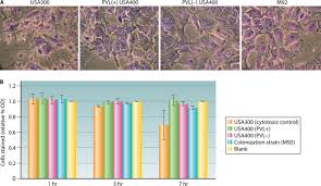 We would like to show you a description here but the site won't allow us. Methicillin Resistant Staphylococcus Aureus Molecular Characterization Evolution And Epidemiology Clinical Microbiology Reviews