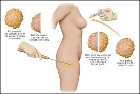 Pin On Plastic And Reconstructive Surgery Blogs