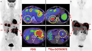 For each network, it shows the signal strength, security type, channel information, and more. Molecular Imaging In The Investigation Of Hypoglycaemic Syndromes And Their Management In Endocrine Related Cancer Volume 24 Issue 6 2017