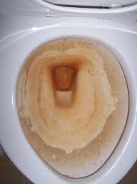 How To Remove Well Water Stains Hunker Toilet Cleaning Toilet Hard Water Stains Cleaning Toilet Stains