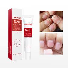 Nail Repair Gel Nail File Set Fungus Removal Gel Anti Infection Nail Treatment Kit For Nail Care Nail Repair Fungal Nail Treatment Nail Treatment