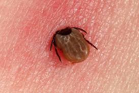 Image result for infected tick bite