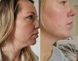 Thrilled with the results