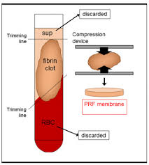 Related image