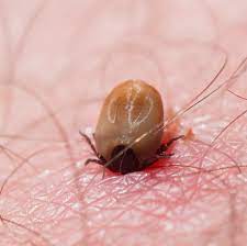 Ticks (suborder ixodida) are parasitic arachnids that are part of the superorder parasitiformes. Tick Bite Pictures Symptoms What Does A Tick Bite Look Like