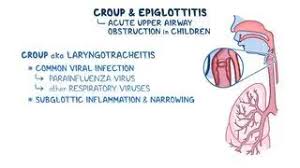 Image result for Croup