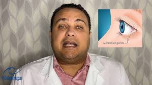 ¿QUÉ SON LOS PÁRPADO?