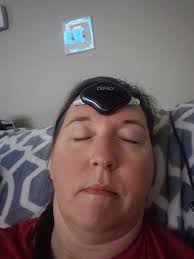 Experiences with using Cefaly for migraines?