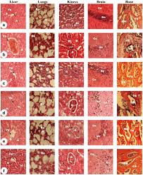 Image result for Anthonotha macrophylla