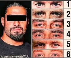 Wow! Unbelievable that its eye was not permanently damaged.