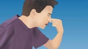 Lovitura la nas, la 1 luna de la rinoplastie!!! Primul Ajutor Ce Faci Cand Iti Curge Sange Din Nas Mobile