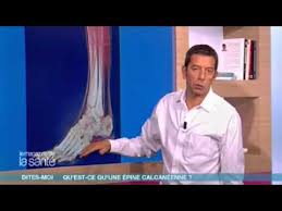 Cela ébranle le talon et entraîne une vascularisation qui régénère l'insertion du tendon. Qu Est Ce Qu Une Epine Calcaneenne Allo Docteurs Youtube