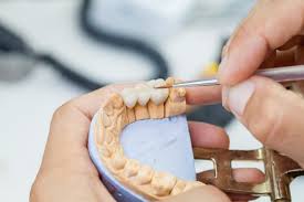 Is porcelain crown worth it? How Much Does Dental Crown Cost Thornhill Dental Office