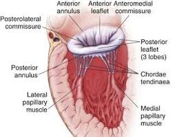 Primary Vs Secondary Mitral Regurgitation 5 Facts To Know Mitral Valve Heart Valves Surgery Facts