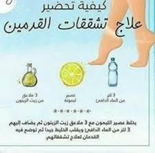 علاج تشققات الرجلين فازلين مليحة ستخدمتها انا شخصيا ترطب و تنحي لقشور لخشان كاين وصفة تاع زمان و هي تذويب شمع ثم اضافة زيت زيتون له مع تحريك جيدا و دهن بيه